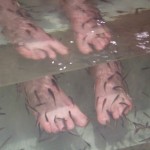 Fishy skin treatment Fishy skin treatment